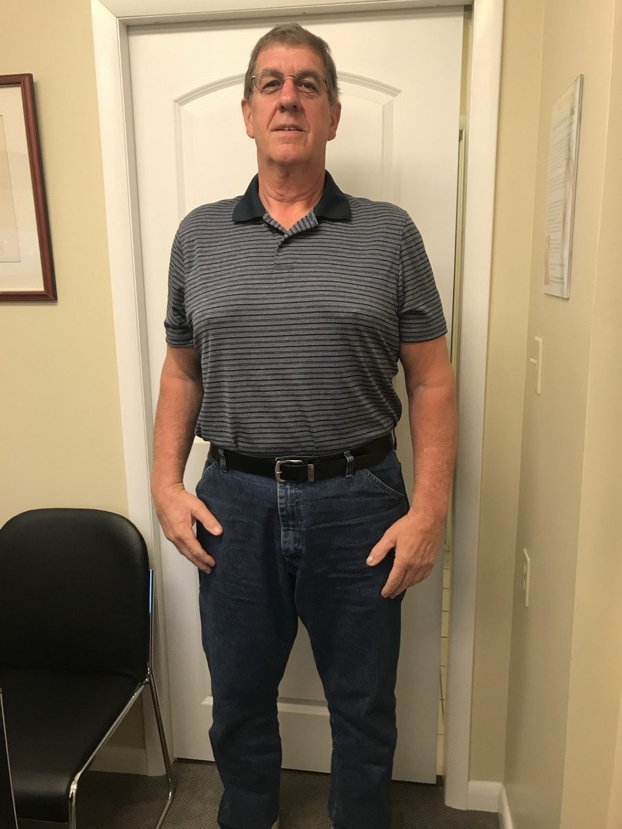 Same patient after completing Dr. Augello's program.