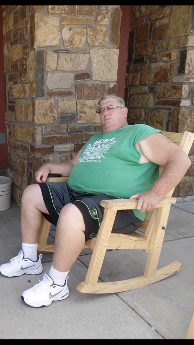 Patient before completing Dr. Augello's program.